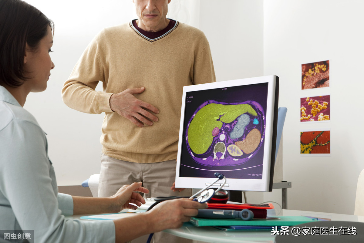 腹部CT不仅能检查腹部，还能检查出这几种肝病
