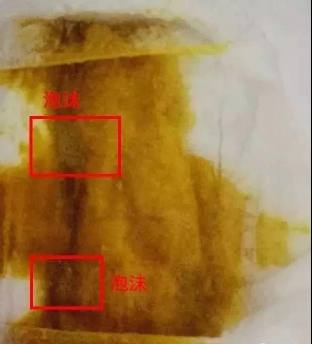 重口味科普：你的宝宝便便正常吗？宝宝各种便便全解