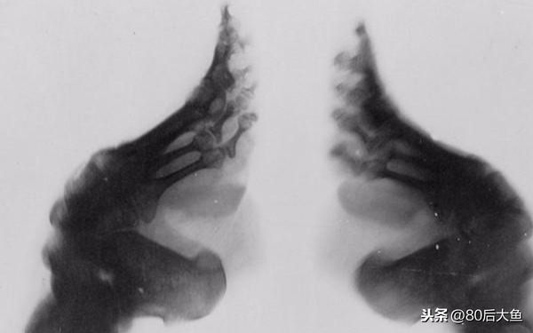 古人裹脚是为什么？三寸金莲脚的10个奇怪事实