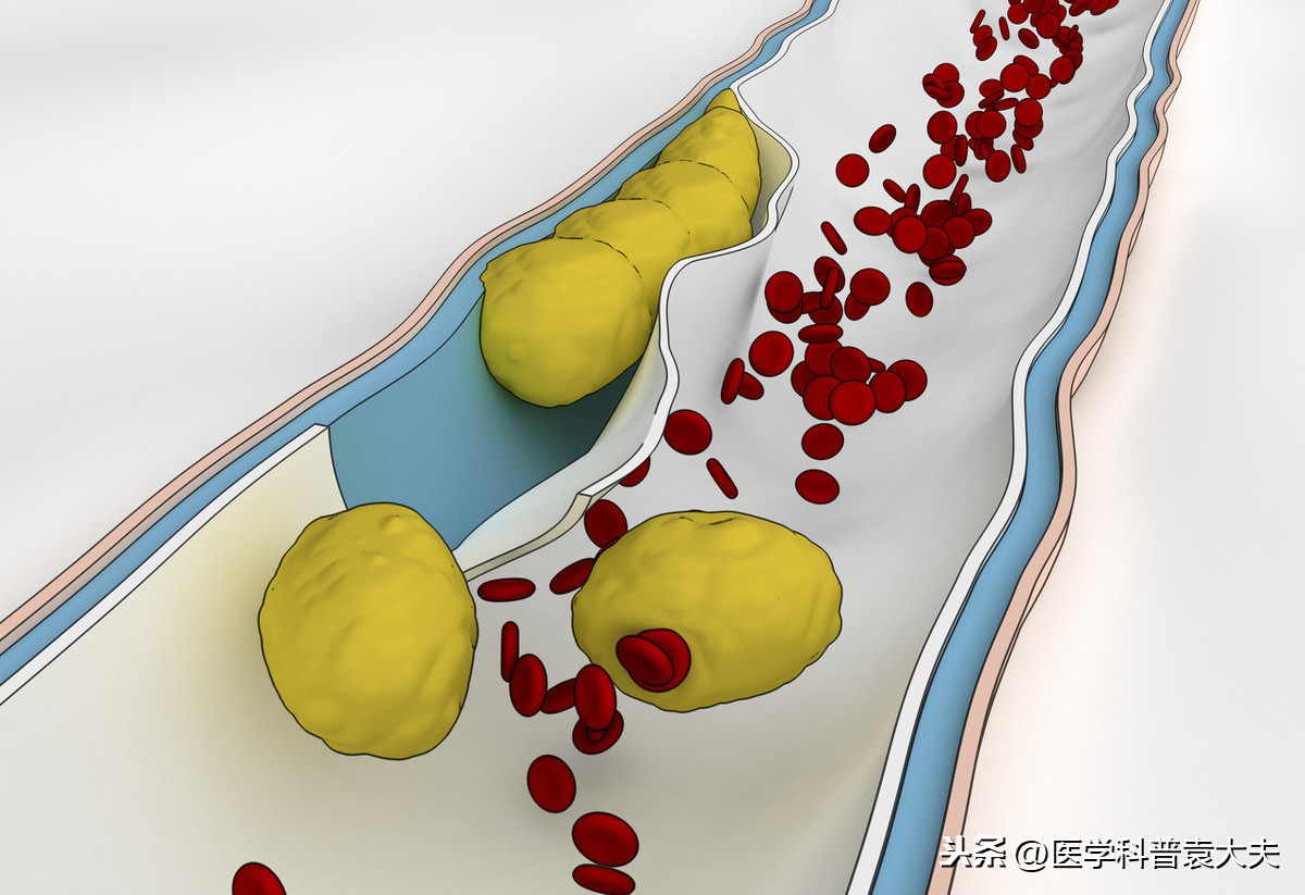 胆固醇作用有哪些（一文了解胆固醇的四大作用）