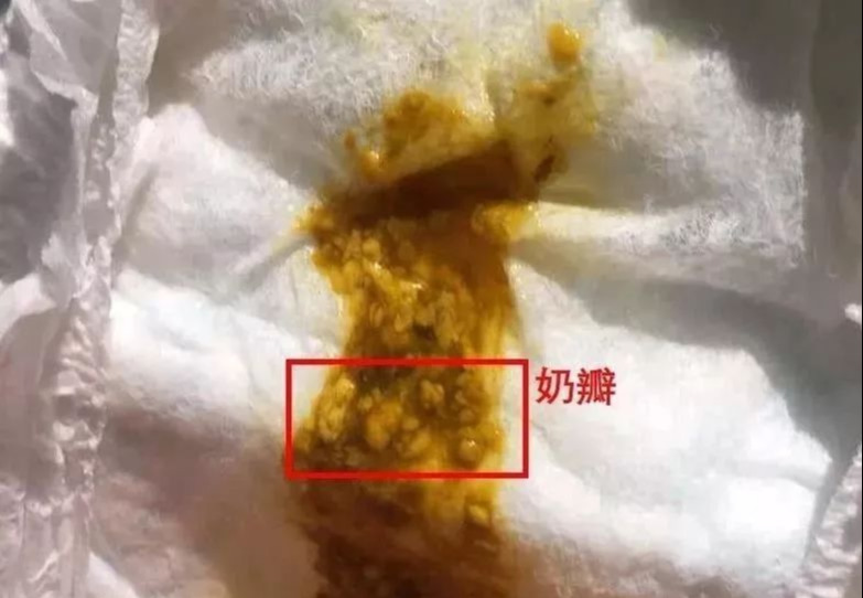 重口味科普：你的宝宝便便正常吗？宝宝各种便便全解