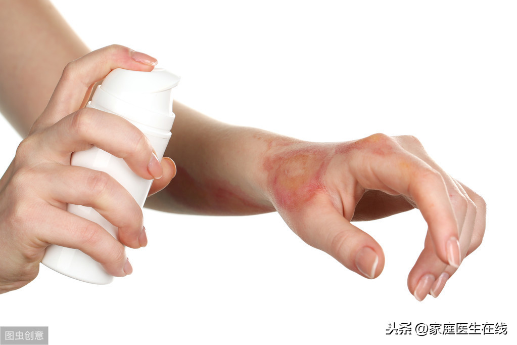 皮肤烫伤了，该怎么处理？教你几个方法来急救