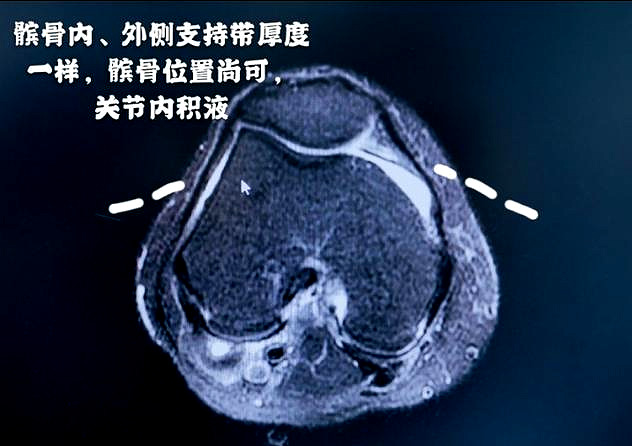 自己阅片，不看报告单的骨科医生水平就高吗？医生辟谣给您说清楚