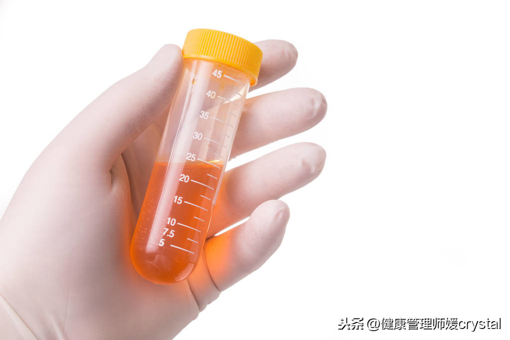 孩子尿液白色有沉淀，是不是健康有问题？4个方法判别