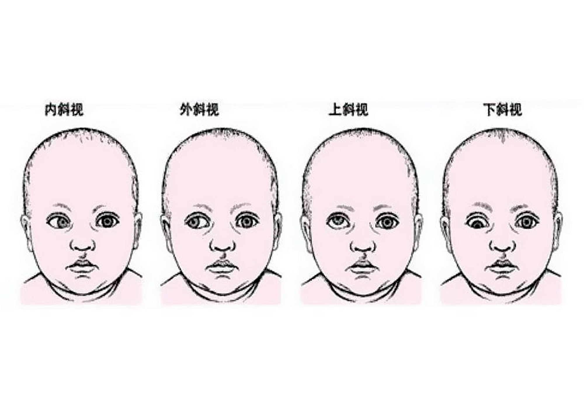 如何判断宝宝对眼图片图片