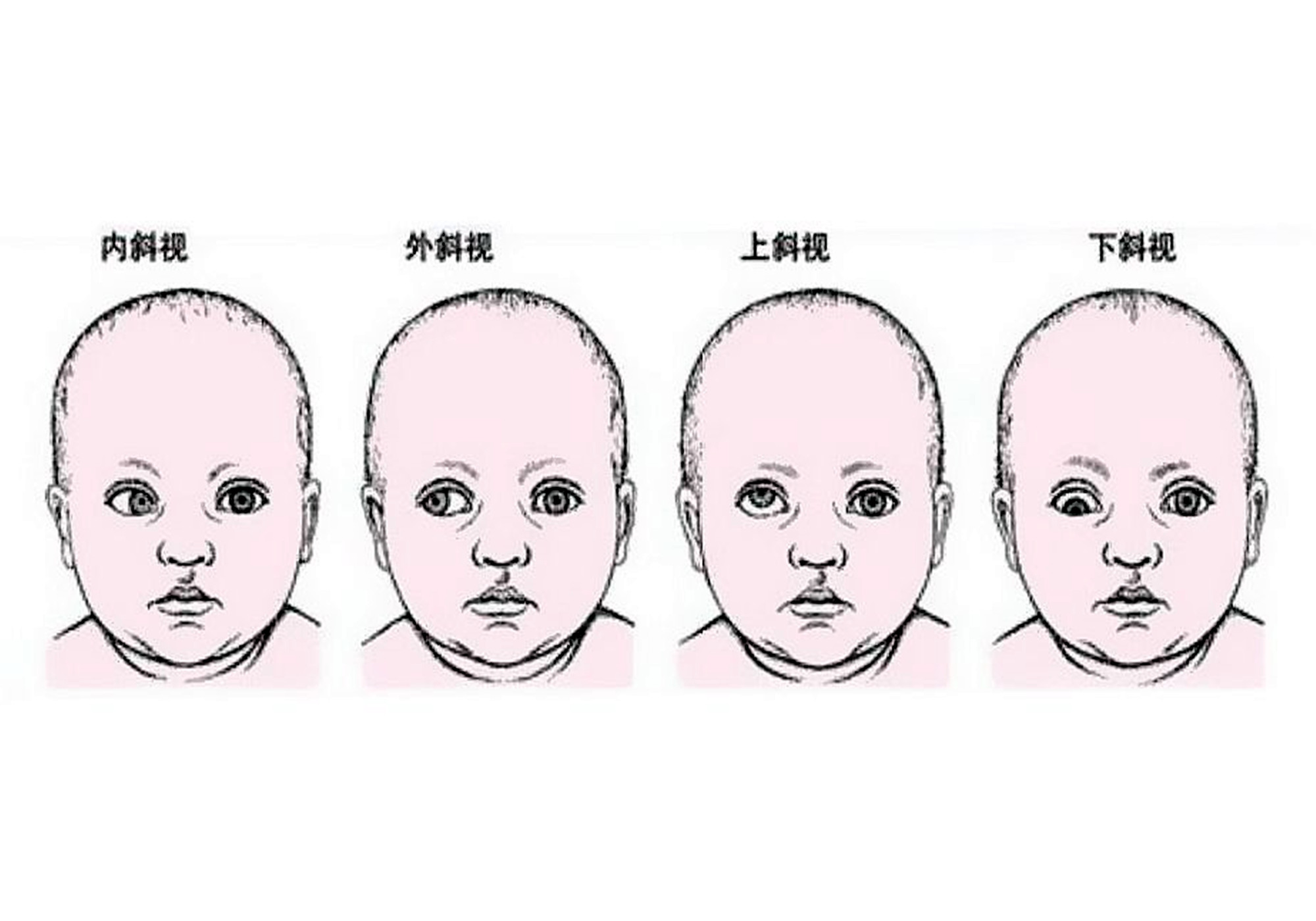 1岁宝宝求医遭拒，引家长不满，宝妈：斗鸡眼这么丑，凭啥不给治