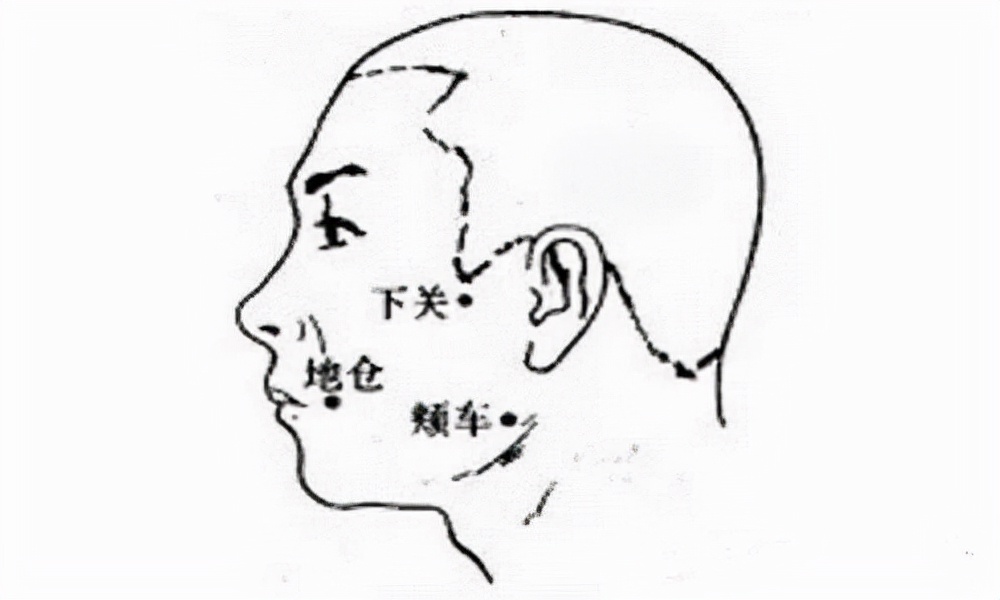 “天下第一痛”，中医也有招