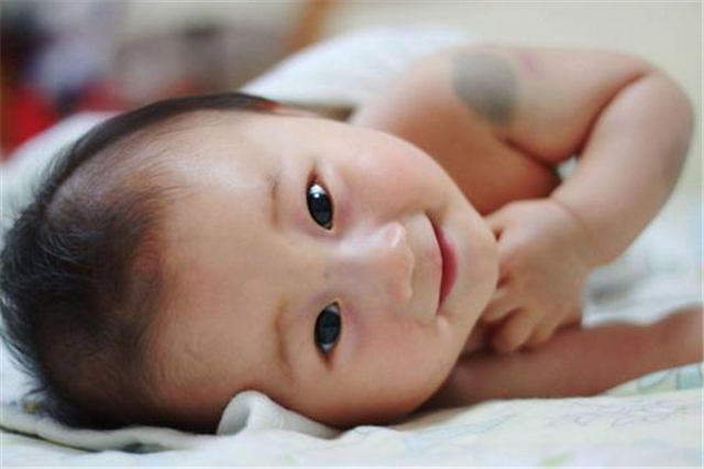 孩子的“胎记”从何而来？孕期这些举动是“诱因”，宝妈要避免