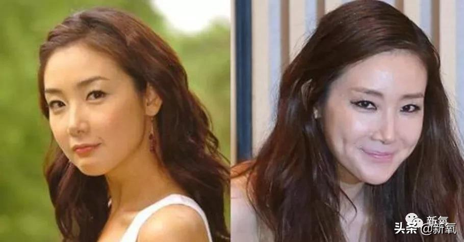 韩国悲剧女王崔智友,明明大眼睛水汪汪,但是整体长相却很悲情?