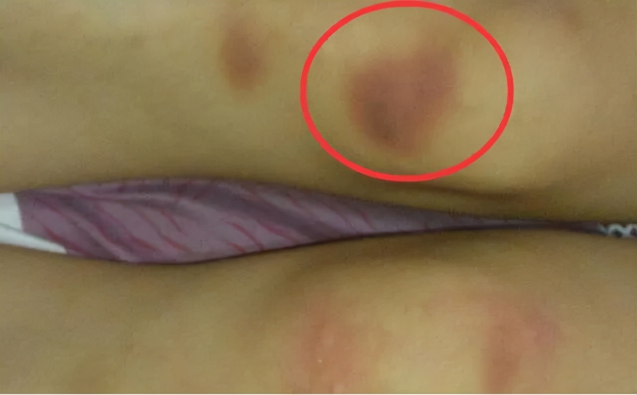 儿子在幼儿园遭受霸凌，机智爸爸这样应对，家长看后盛赞：高情商