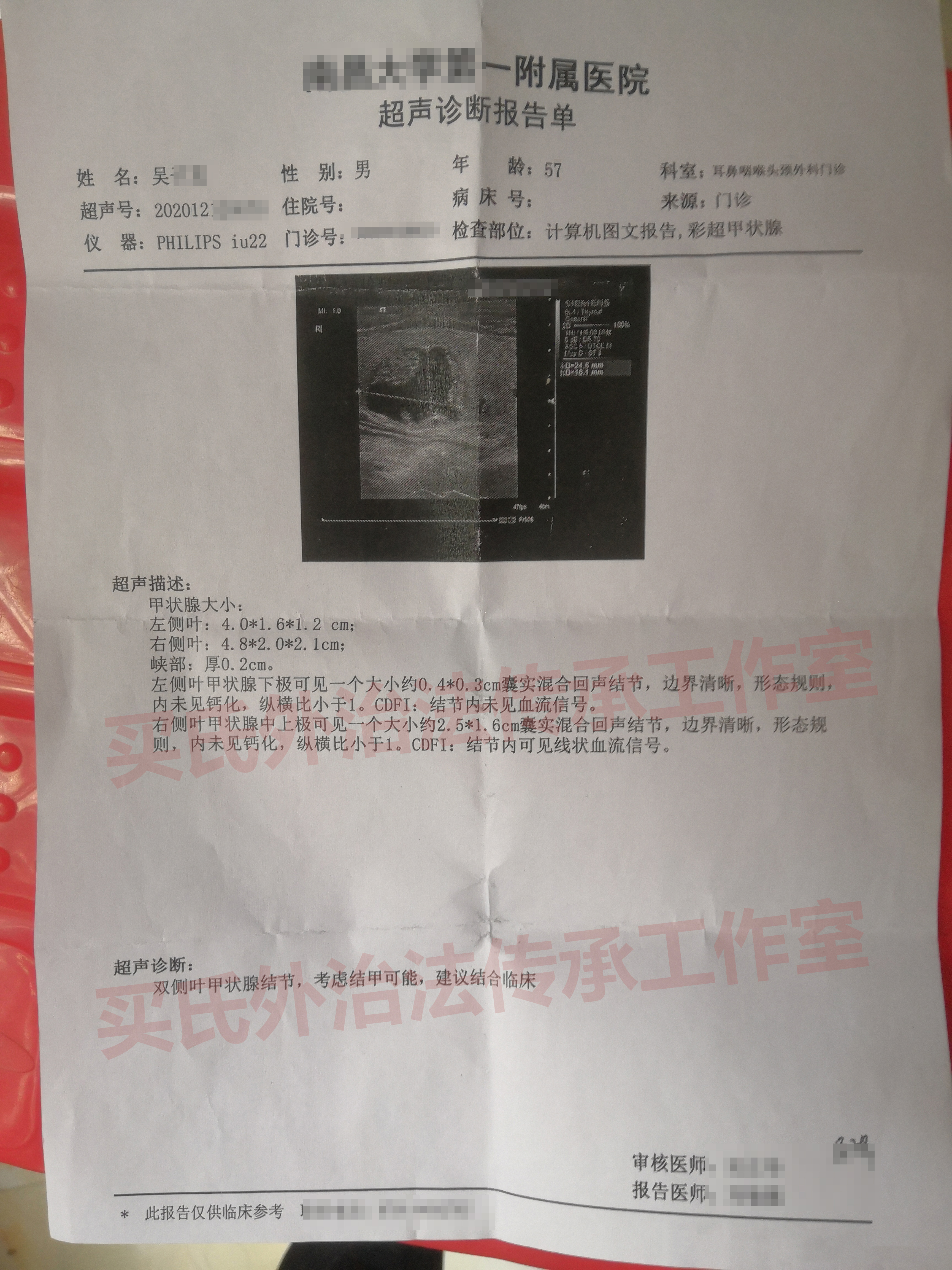 2.5公分甲状腺囊实混合回声结节，中医辨证外治内服，结节消除