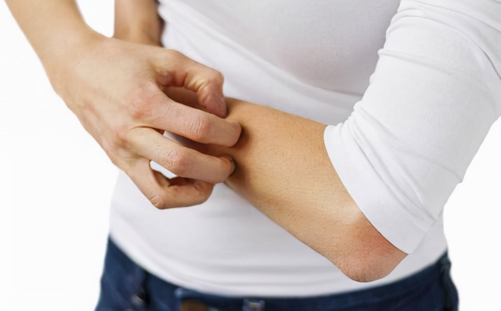 痒痒痒！教你几个远离冬季皮肤瘙痒小妙招