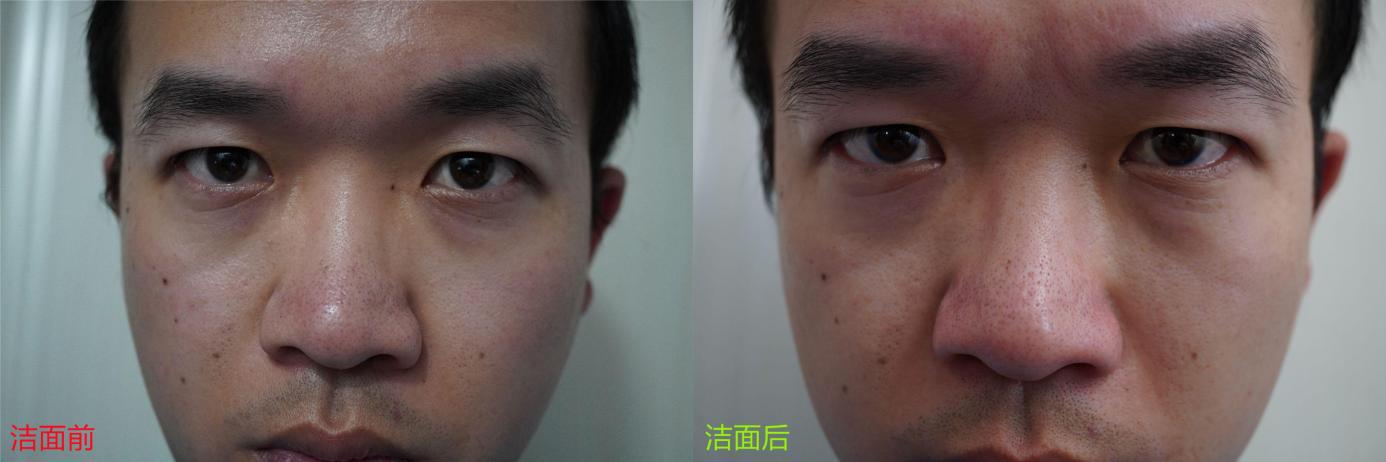 控油在路上！如何拯救你的油性皮肤，清爽整夏？