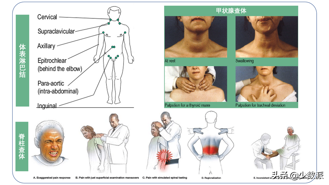 体检到底应该检查什么