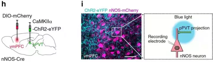 神经领域中「特异性启动子AAV」的妙用