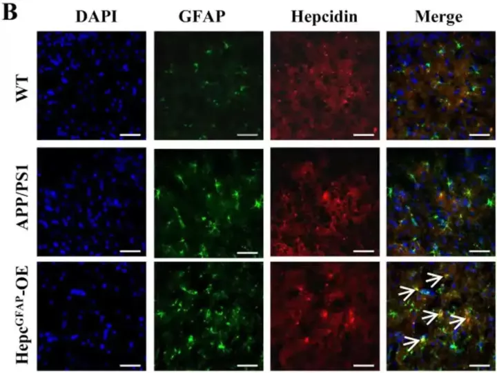 神经领域中「特异性启动子AAV」的妙用