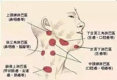 淋巴结是什么？淋巴结肿大又是怎么回事？医生解释清楚