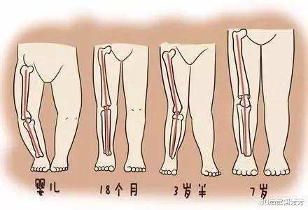 出生的婴儿要绑腿，你们家的孩子绑过腿吗？有必要吗？