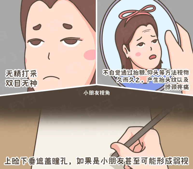 眼皮没力氣，不是“睡不醒”，而是“上睑下垂”这种病