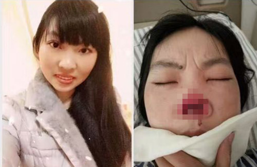 鼻子被咬掉，逼女儿闹市挂牌下跪，弱女为何忍受家暴11年