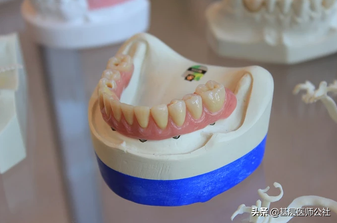 牙痛神药人工牛黄甲硝唑和甲硝唑的区别，这篇文章说清了