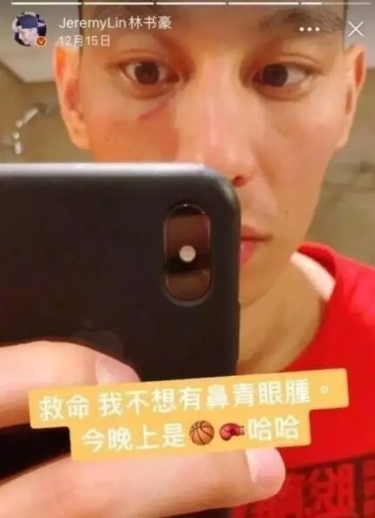 林书豪在nba为什么被针对(争议不断，被多次侵犯的林书豪在CBA真的被“特殊照顾”了吗？)