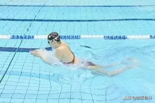 毁气质的 “脖子前倾”,明星也逃不过,医生送你4招拯救!