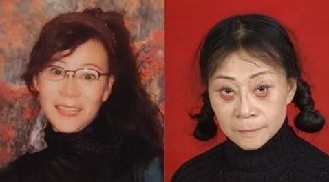 国外一女子花钱割了眼袋,如今"闭眼困难",其实变美不用这么麻烦
