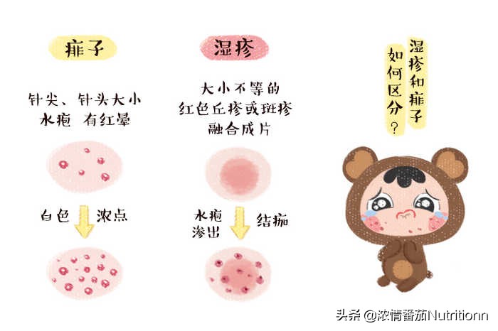 婴儿阴囊湿疹图片(夏季如何分辨宝宝湿疹和痱子) 