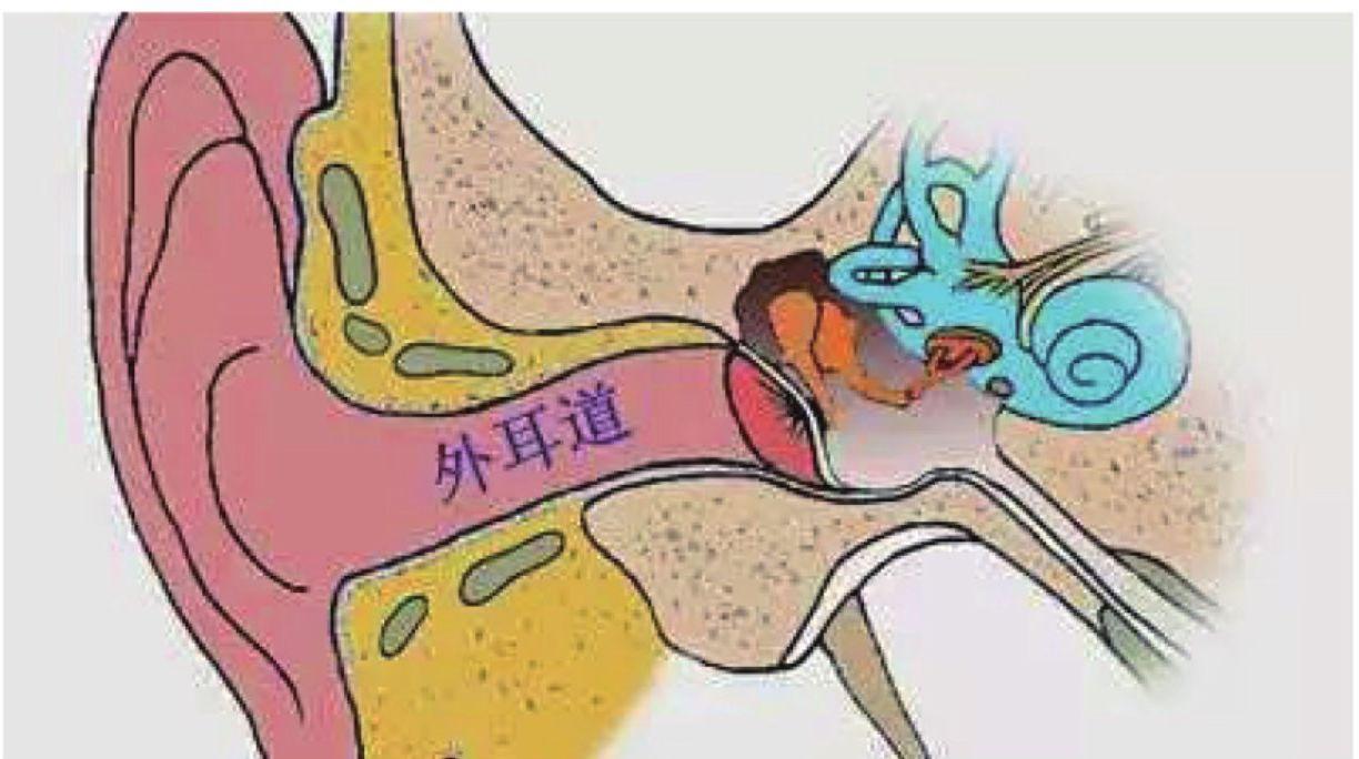 耳朵发炎,可别不在意!外耳道炎,中耳炎,你了解多少?