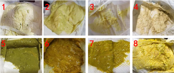 如何区分宝宝是胆道闭锁还是生理性黄疸?