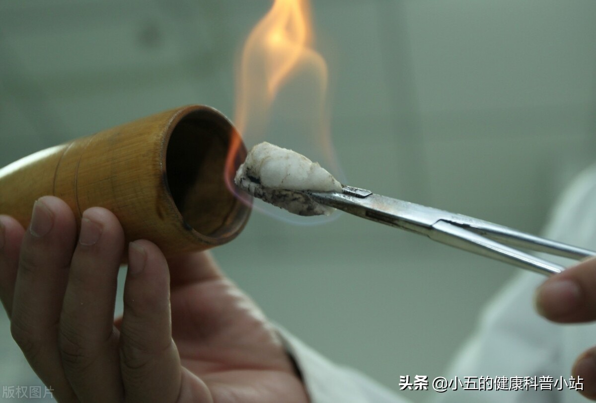 夏天拔罐后颜色越深说明湿气越重？关于拔罐你一定要知道的知识