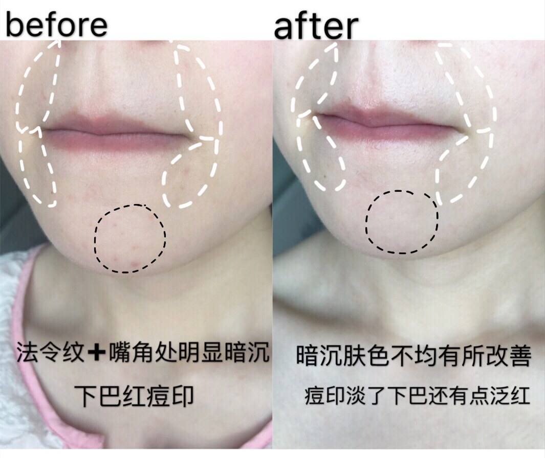 23岁林允现在太成熟了！镜头怼脸很自信，最吸睛的还是“蛋白肌”
