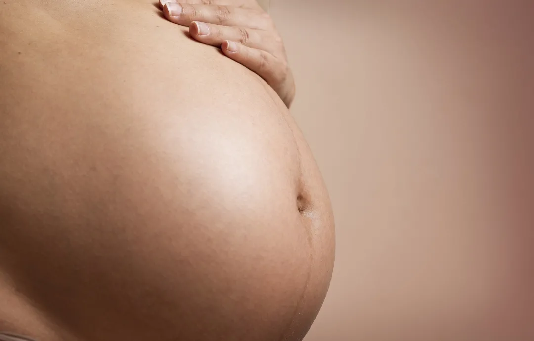 孕妇大腿长妊娠纹图片（对付妊娠纹可能有效的方法）