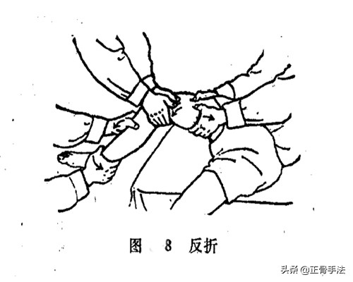 掌握了这8种正骨接骨手法，遇到骨折伤痛都可以轻松调理