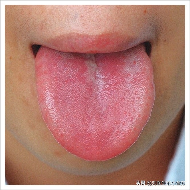 《中医舌诊》,9大体质舌诊图,看看你属于哪种?