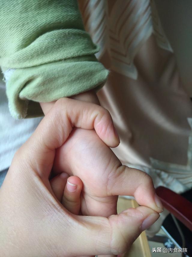 小儿狭窄性腱鞘炎的成因解析