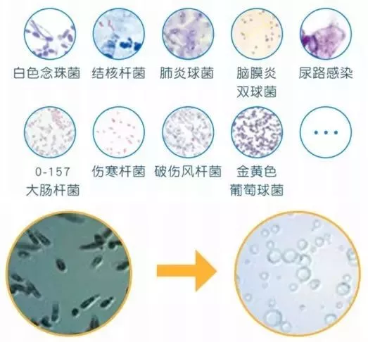 衣服不用洗，一泡就干净！73岁老人研发洗衣神器，颠覆洗衣方式