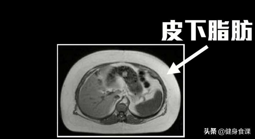 为什么抽脂手术能够减肥？但是这2个方法，减肥更有效更省钱