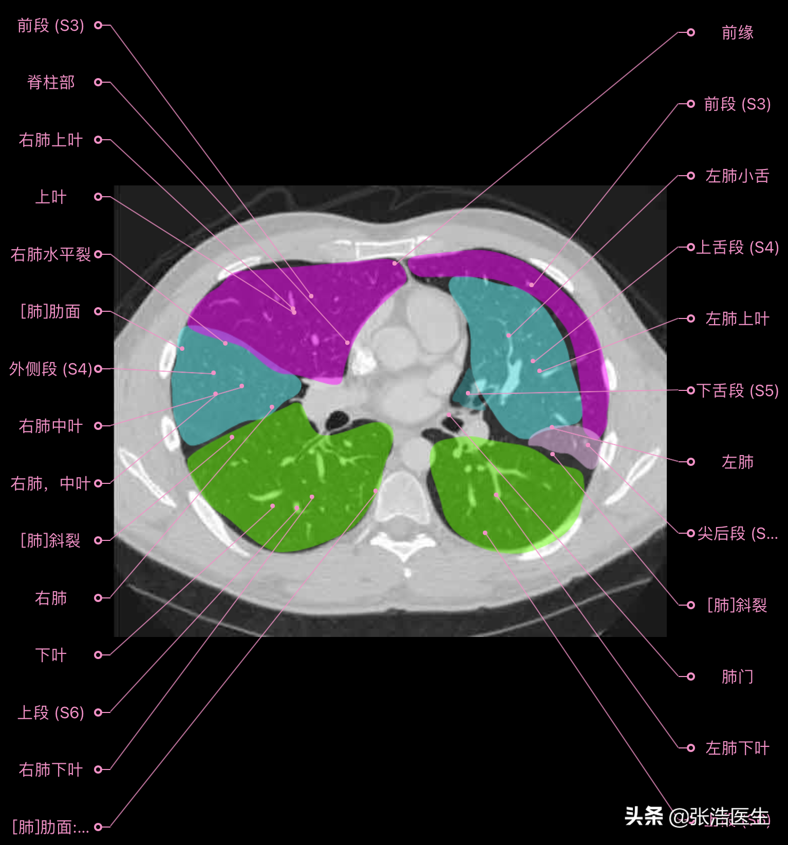 肺ct片图片图解图片