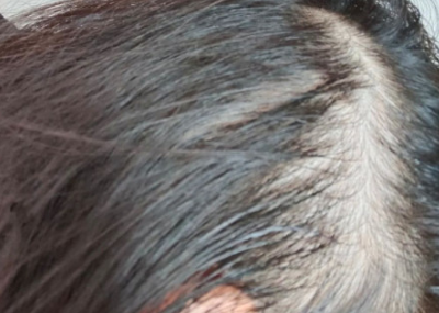 洗发水黑名单大吐槽，各个都是“脱发神器”, 难怪发际线上移