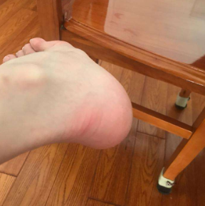 脚后跟经常会疼？原因无非这4种之一！摸清楚，对症解决并不难