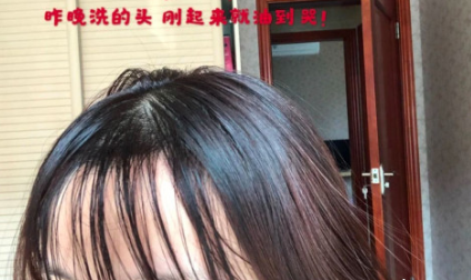 洗发水黑名单大吐槽，各个都是“脱发神器”, 难怪发际线上移