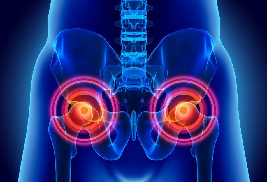 好好的股骨头,怎么就坏死了?医生:先说说你喝了多少酒?