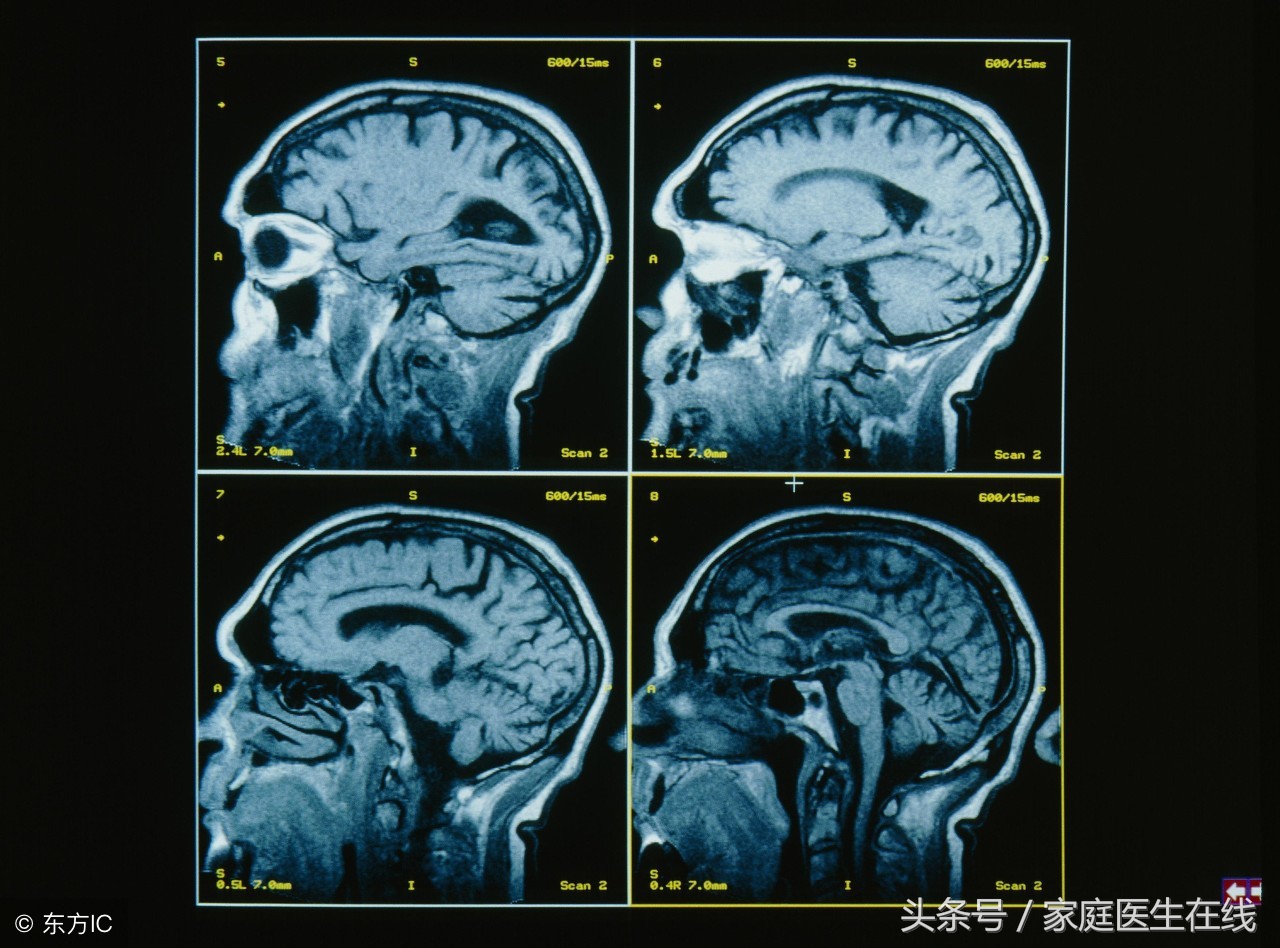 哪些器官出现问题，需要用核医学检查？答案在文末