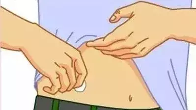 怎样注射胰岛素（有图有真相）超级详细！