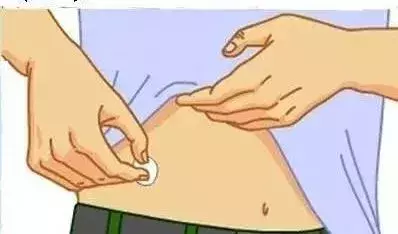 怎样注射胰岛素（有图有真相）超级详细！