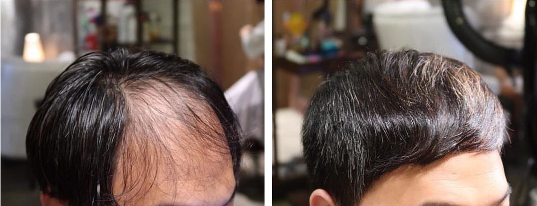 男生发际线高，头发稀少，剪这些发型就对了！
