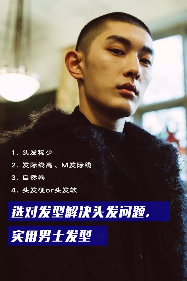 男生发际线过高怎么办？改善方法有哪些？