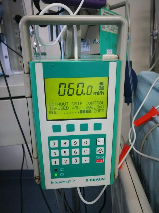ICU中常用“十大救命神器”和收费（全），最贵一项每天8千多